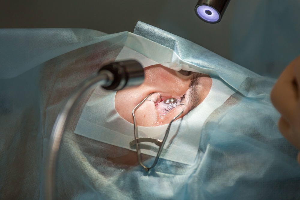 LASIK Istanbul Clinics with Advanced Laser Systems